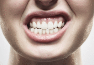 dientes inferiores mover