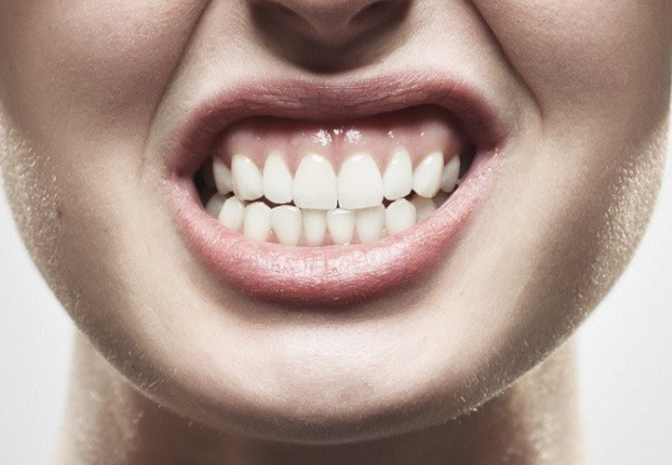 dientes inferiores mover