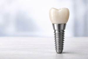 implantes dentales cicatrizar
